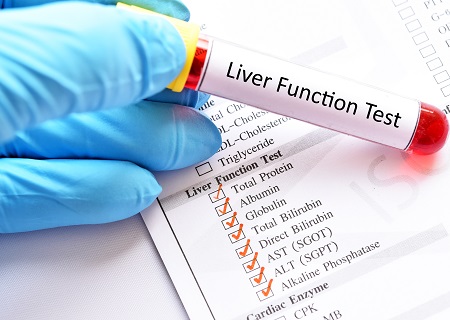 A rizikócsoportoknak tünet nélkül is fontos a hepatológiai vizsgálat. 
